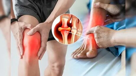 Hautbereiche, die für die Anwendung von Icexin-Gel geeignet sind (Knie, Ellbogen, unterer Rücken)