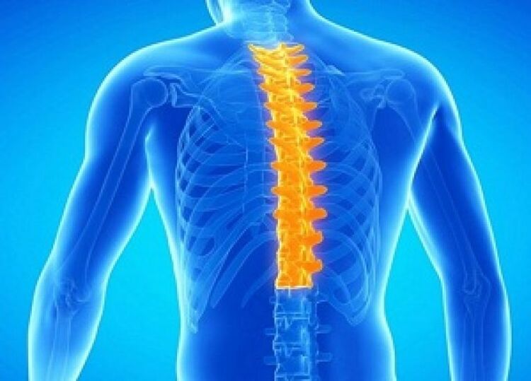 Osteochondrose der Brustwirbelsäule
